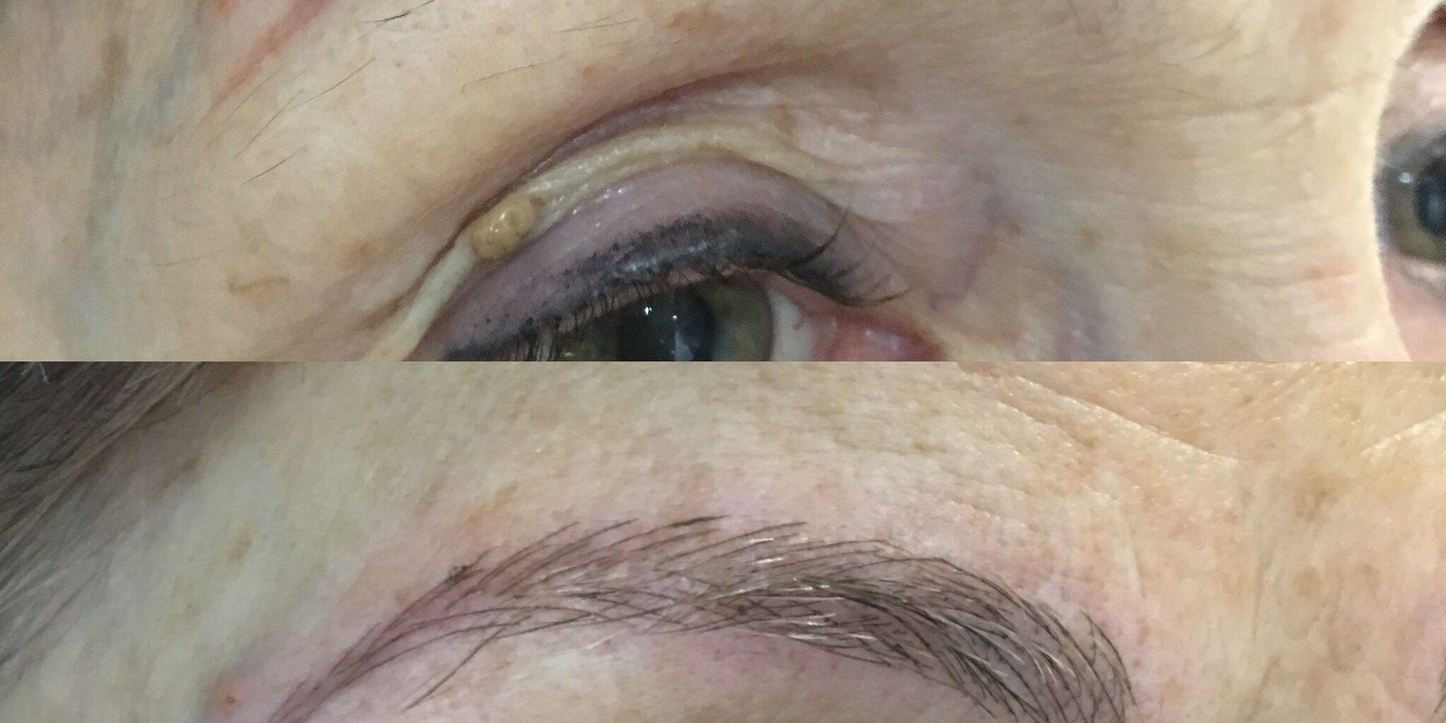 b-tattoo-correction-with-microblading-technique