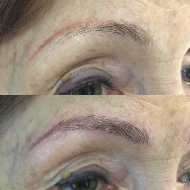 b-tattoo-correction-with-microblading-technique