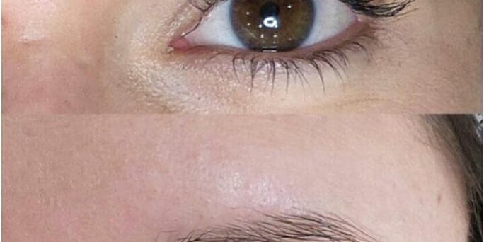 microblading-Reigate-Surrey