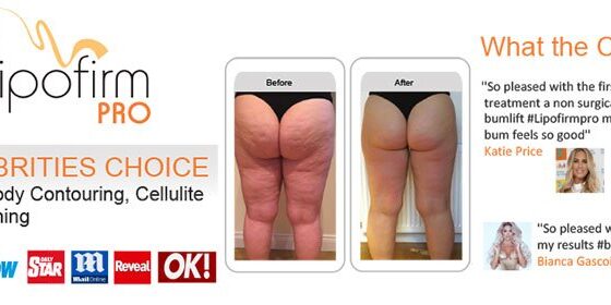 slide-lipofirm-pro-surrey