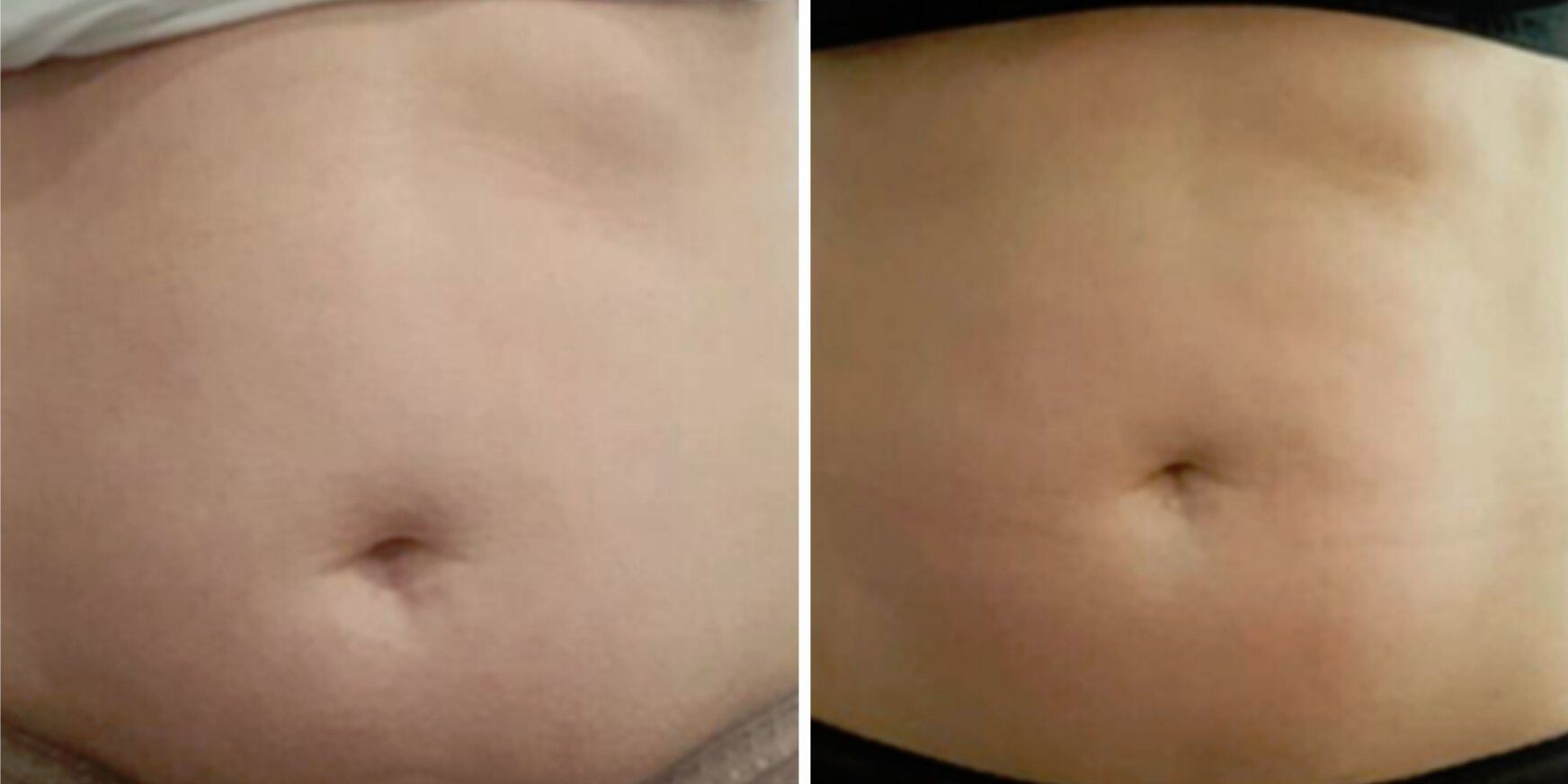 tummy4